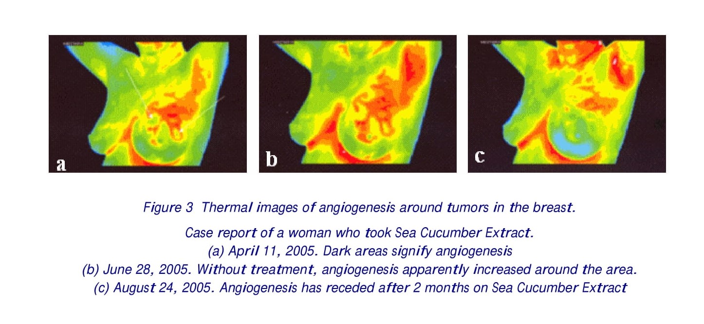 Sea Cucumber Extract and Extracts of Cyperus and Curcuma A novel